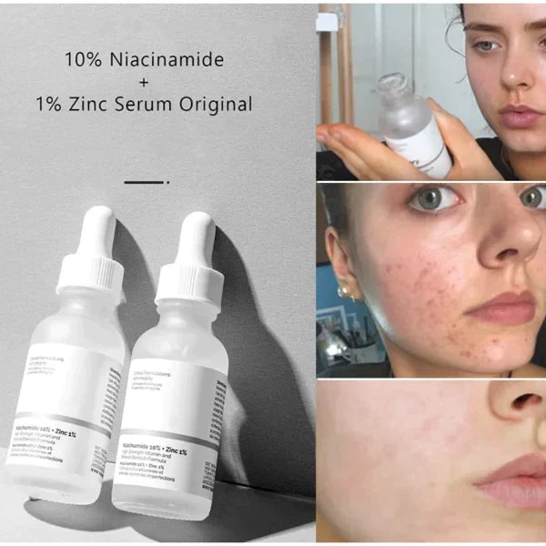 The Ordinary Niacinamide Face Serum